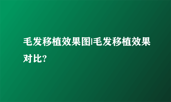 毛发移植效果图|毛发移植效果对比?