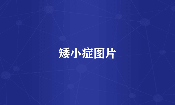 矮小症图片